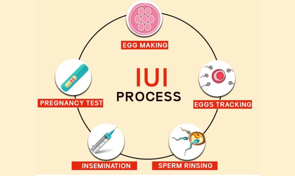 chances after IUI treatment