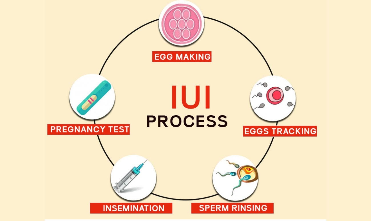 chances after IUI treatment