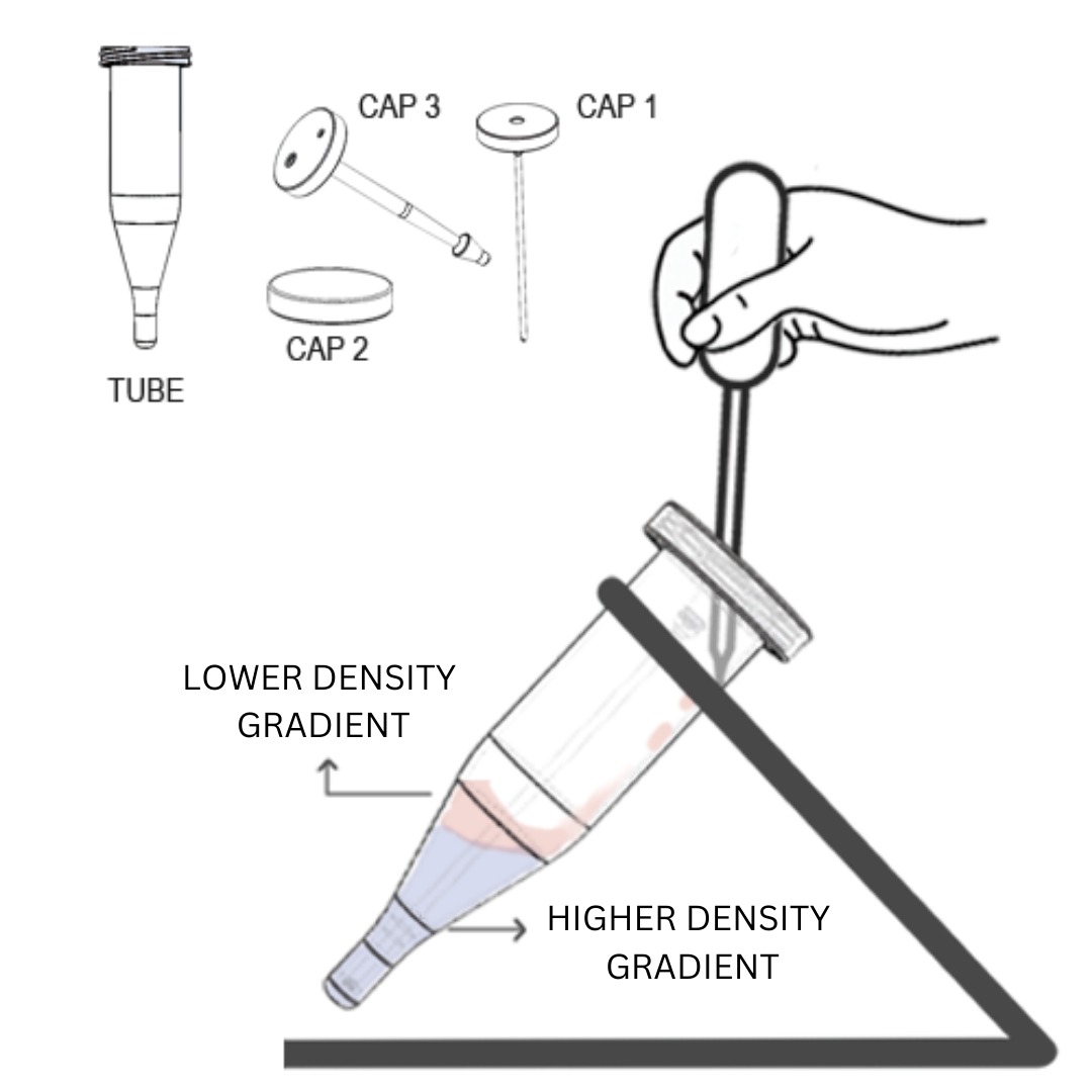 higher density media after sperm wash in androwash